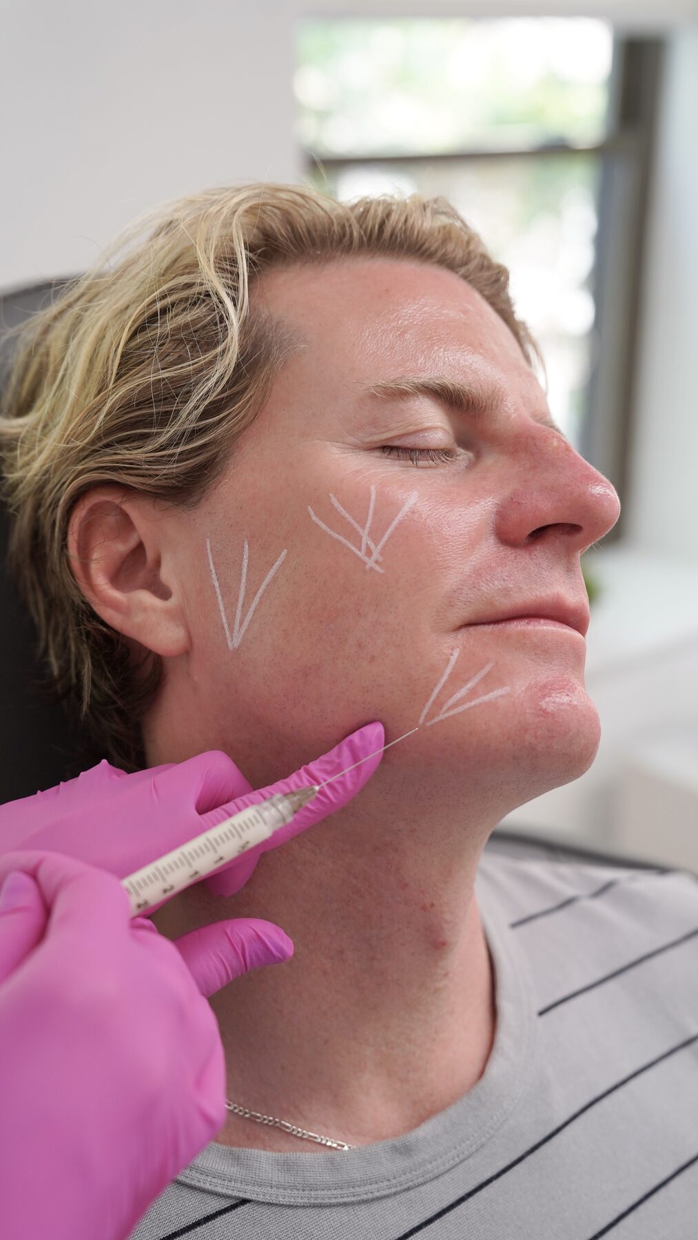 Aesthetic provider performing a facial treatment