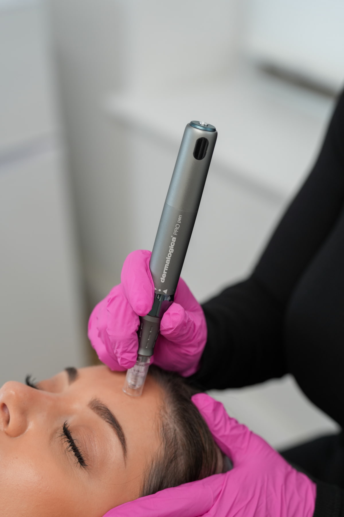 Nano Infusion Microneedling Feature Image