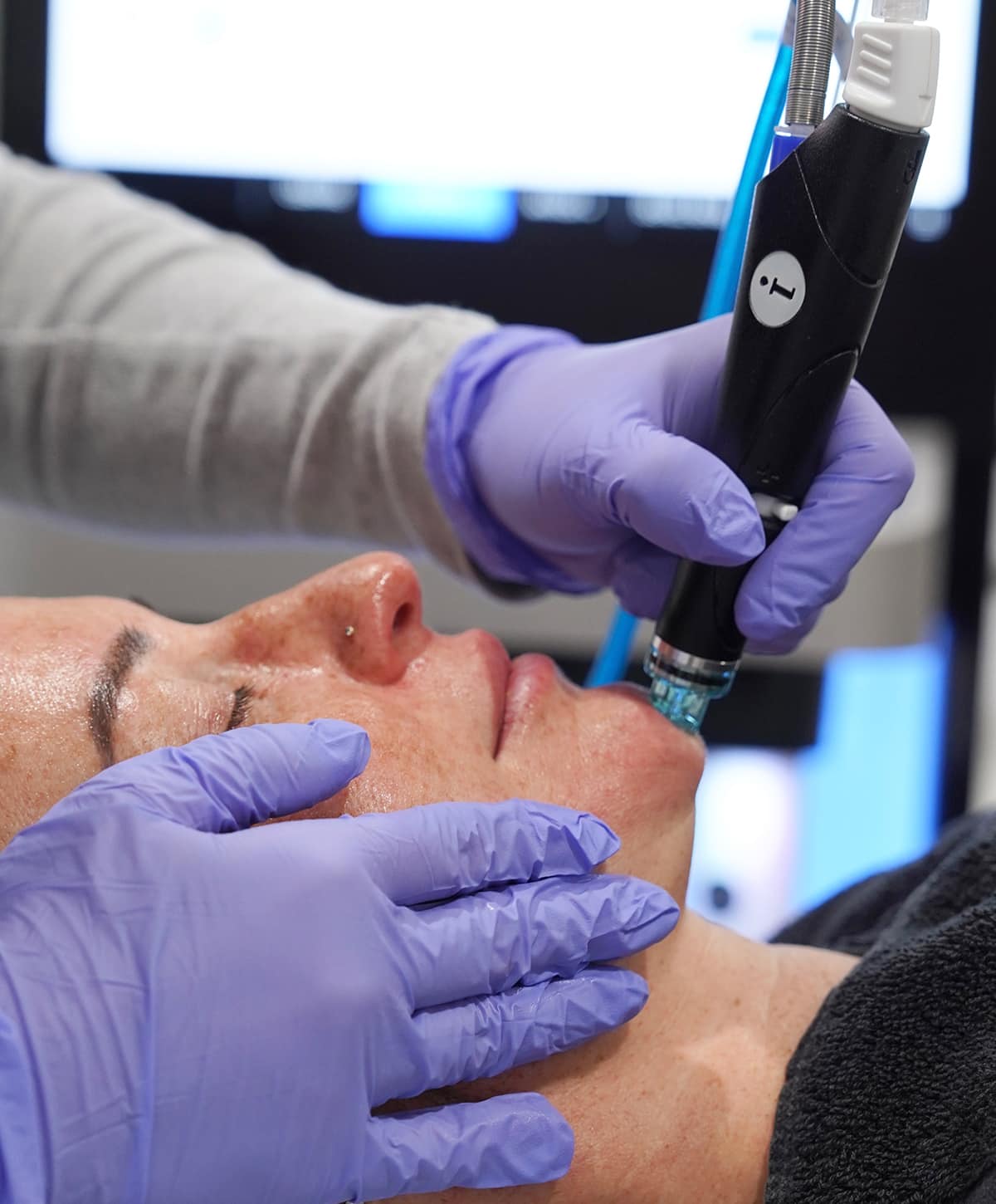 Boston Hydrafacial