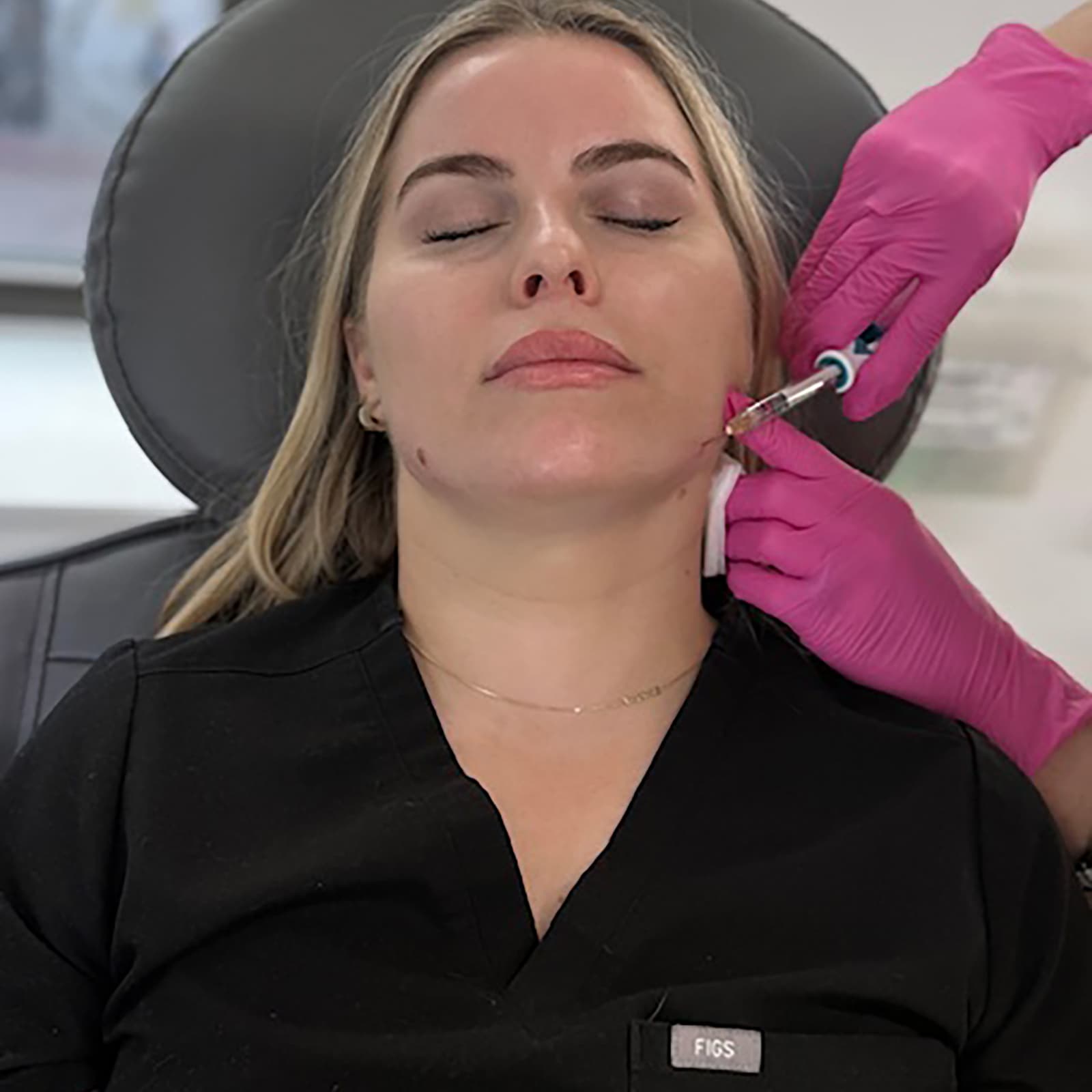 juvederm volux patient model resting her elbow on her knee while smiling at camera